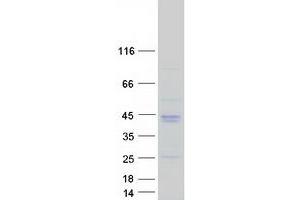 Image no. 1 for Osteoglycin (OGN) (Transcript Variant 3) protein (Myc-DYKDDDDK Tag) (ABIN2726014)