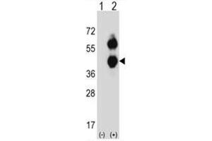 Image no. 2 for anti-Branched Chain Amino-Acid Transaminase 2, Mitochondrial (BCAT2) (AA 308-336), (C-Term) antibody (ABIN950618)