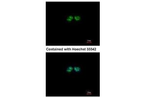 ICC/IF Image Immunofluorescence analysis of paraformaldehyde-fixed A431, using CSN1, antibody at 1:500 dilution.