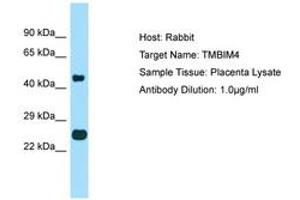 Image no. 1 for anti-Transmembrane BAX Inhibitor Motif Containing 4 (TMBIM4) (AA 110-159) antibody (ABIN6750079)