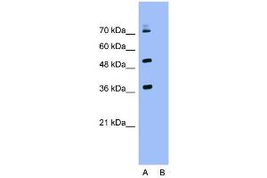 Image no. 4 for anti-Kelch-Like ECH-Associated Protein 1 (KEAP1) (C-Term) antibody (ABIN2775979)