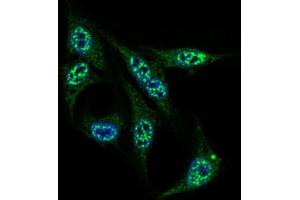 Image no. 4 for anti-Inner Centromere Protein Antigens 135/155kDa (INCENP) (AA 369-583) antibody (ABIN1844019)