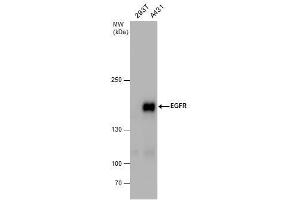 Image no. 1 for anti-Epidermal Growth Factor Receptor (EGFR) (N-Term) antibody (ABIN2854848)
