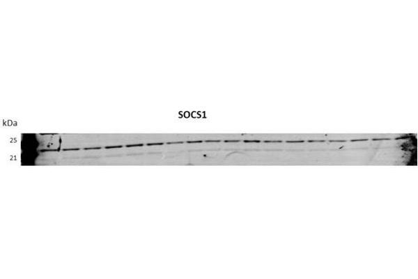 SOCS1 antibody  (N-Term)