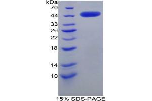 Image no. 1 for Corticotropin Releasing Hormone (CRH) protein (ABIN3009007)