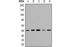 Image no. 2 for anti-GDP Dissociation Inhibitor 2 (GDI2) (C-Term) antibody (ABIN3222894)