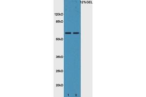 Image no. 2 for anti-Interleukin 22 Receptor, alpha 1 (IL22RA1) (AA 41-150) antibody (ABIN748178)