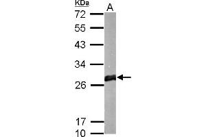 Image no. 2 for anti-Glutathione S-Transferase mu 1 (GSTM1) (Center) antibody (ABIN2856903)