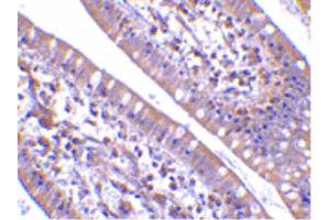 Image no. 2 for anti-Cell Death-Inducing DFFA-Like Effector B (CIDEB) (Internal Region) antibody (ABIN6656669)