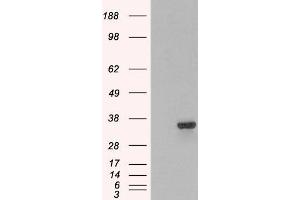 Image no. 1 for anti-Proteasome (Prosome, Macropain) Inhibitor Subunit 1 (PI31) (PSMF1) (C-Term) antibody (ABIN184933)