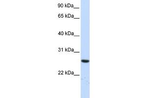anti-Tetratricopeptide Repeat Domain 33 (TTC33) (N-Term) antibody
