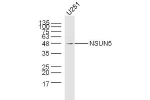 Image no. 1 for anti-NOP2/Sun Domain Family, Member 5 (NSUN5) (AA 2-100) antibody (ABIN5675698)