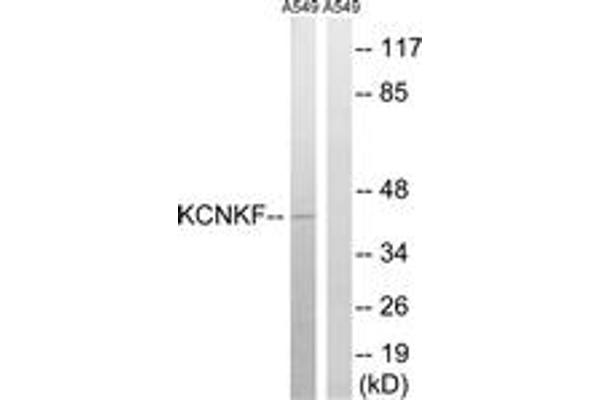 KCNK15 Antikörper  (AA 273-322)