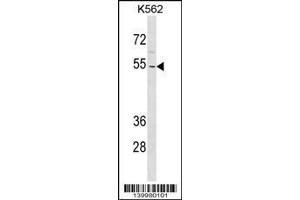 Image no. 1 for anti-Zinc Finger Protein 736 (ZNF736) (AA 49-75), (N-Term) antibody (ABIN1539408)