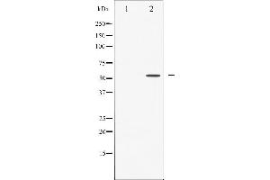 Image no. 4 for anti-Caspase 8 (CASP8) (pSer347) antibody (ABIN6256281)