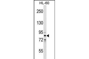 ZN Antibody (N-term) (ABIN1539006 and ABIN2849253) western blot analysis in HL-60 cell line lysates (35 μg/lane).