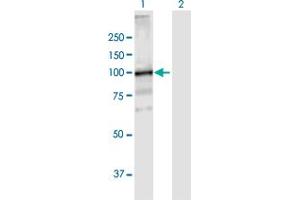 Image no. 1 for anti-Vacuolar Protein Sorting 39 Homolog (VPS39) (AA 1-875) antibody (ABIN525102)