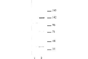 Image no. 1 for anti-Lysine (K)-Specific Demethylase 4C (KDM4C) antibody (ABIN6972254)