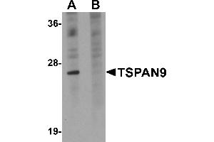 Image no. 2 for anti-Tetraspanin 9 (TSPAN9) (Middle Region) antibody (ABIN1031151)