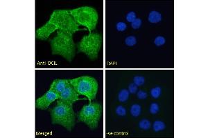 Image no. 1 for anti-C-Type Lectin Domain Family 2, Member D (CLEC2D) (Internal Region) antibody (ABIN6391372)