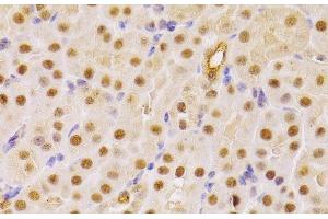 Immunohistochemistry of paraffin-embedded Mouse kidney using CDC25A Polyclonal Antibody at dilution of 1:100 (40x lens).