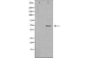 Image no. 2 for anti-Colony Stimulating Factor 2 Receptor, Alpha, Low-Affinity (Granulocyte-Macrophage) (CSF2RA) (Internal Region) antibody (ABIN6261055)