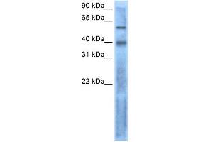 Image no. 2 for anti-Left-Right Determination Factor 2 (LEFTY2) (N-Term) antibody (ABIN2777146)