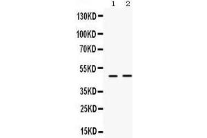 Image no. 1 for anti-Inhibitor of Growth Family, Member 1 (ING1) (AA 192-223), (Middle Region) antibody (ABIN3042467)