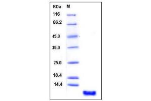 Image no. 1 for S100 Calcium Binding Protein P (S100P) (AA 1-95), (Mature) protein (ABIN2005291)