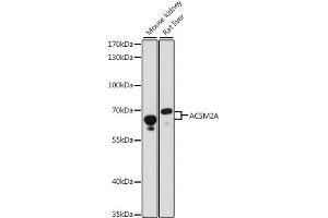 ACSM2A 抗体  (AA 418-577)