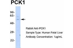 Image no. 1 for anti-phosphoenolpyruvate Carboxykinase 1 (Soluble) (PCK1) (Middle Region) antibody (ABIN2777603)