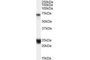 Image no. 2 for anti-Huntingtin Associated Protein 1 (HAP1) (Internal Region) antibody (ABIN334416)