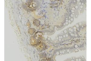 Image no. 2 for anti-Peroxisomal Biogenesis Factor 6 (PEX6) antibody (ABIN6264152)