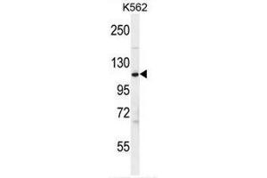 Image no. 3 for anti-Complement Factor H (CFH) (AA 751-780), (Middle Region) antibody (ABIN951646)