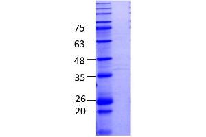 Image no. 2 for LINE1 Retrotransposable Element 1 (L1RE1) (AA 1-338) protein (His tag) (ABIN3083185)