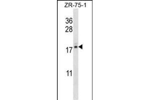 TNP2 抗体  (C-Term)