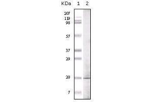 Image no. 1 for anti-Euchromatic Histone-Lysine N-Methyltransferase 1 (EHMT1) antibody (ABIN969480)