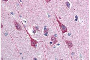 Image no. 1 for anti-Disrupted in Schizophrenia 1 (DISC1) (C-Term) antibody (ABIN337350)