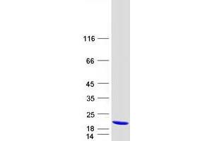 Image no. 1 for Acyl-CoA Thioesterase 13 (ACOT13) protein (Myc-DYKDDDDK Tag) (ABIN2733555)