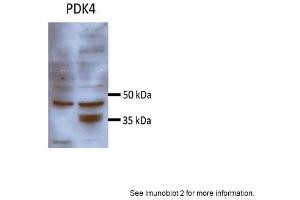 Image no. 2 for anti-Pyruvate Dehydrogenase Kinase, Isozyme 4 (PDK4) (N-Term) antibody (ABIN2777592)