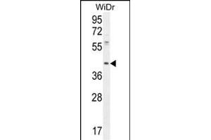DUS4L antibody  (AA 141-170)