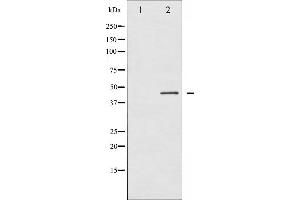 Connexin 43/GJA1 antibody  (pSer368)