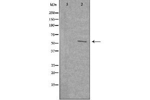 Image no. 3 for anti-WAS Protein Family, Member 3 (WASF3) (Internal Region) antibody (ABIN6257552)