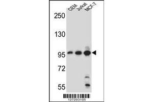 Image no. 3 for anti-Aftiphilin (AFTPH) (AA 844-871), (C-Term) antibody (ABIN651958)