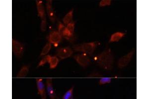 Immunofluorescence analysis of NIH/3T3 cells using IKBKE Polyclonal Antibody at dilution of 1:100.