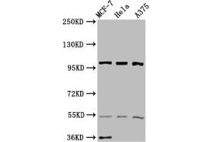 Western Blot Positive WB detected in: MCF-7 whole cell lysate, Hela whole cell lysate, A375 whole cell lysate All lanes: EIF3C antibody at 3.