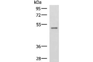 Western blot analysis of Human placenta tissue lysate using GRWD1 Polyclonal Antibody at dilution of 1:800