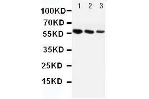 Image no. 1 for anti-Angiotensinogen (serpin Peptidase Inhibitor, Clade A, Member 8) (AGT) (AA 25-36), (N-Term) antibody (ABIN4886440)