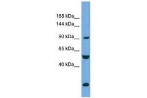 Image no. 1 for anti-Exocyst Complex Component 1 (EXOC1) (AA 35-84) antibody (ABIN6745695)