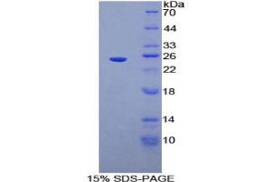 Image no. 1 for Sprouty Homolog 2 (SPRY2) protein (ABIN3011733)